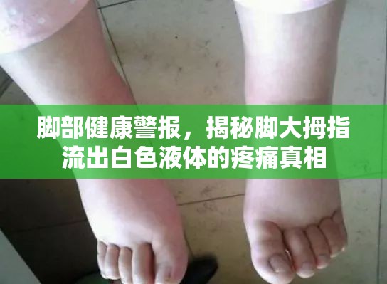 腳部健康警報，揭秘腳大拇指流出白色液體的疼痛真相
