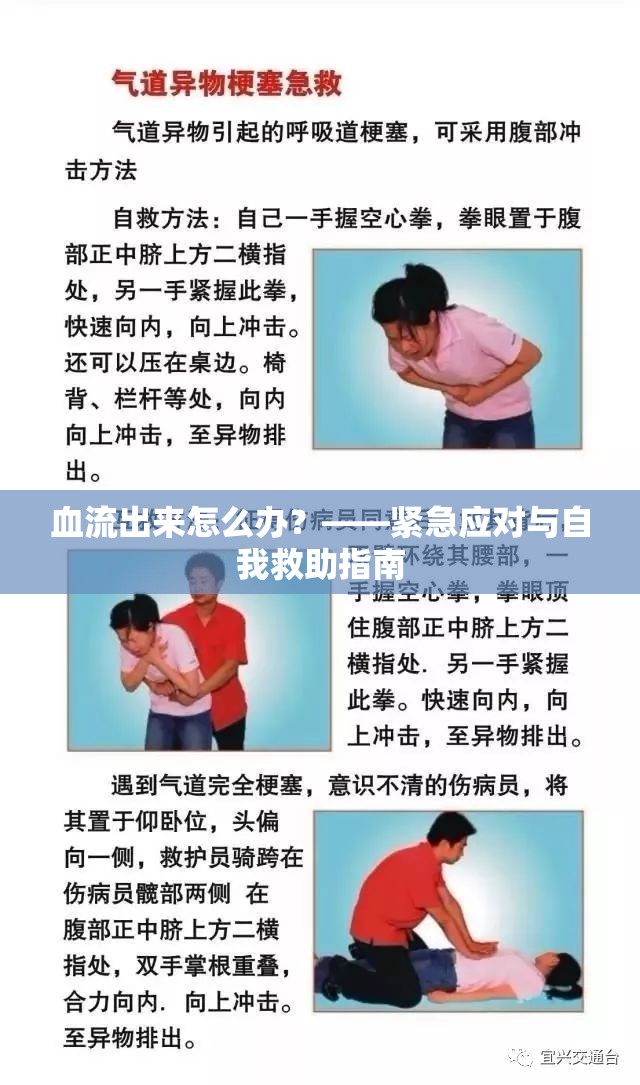 血流出來怎么辦？——緊急應(yīng)對與自我救助指南