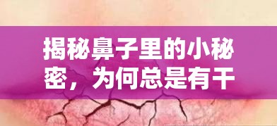 揭秘鼻子里的小秘密，為何總是有干鼻屎流出