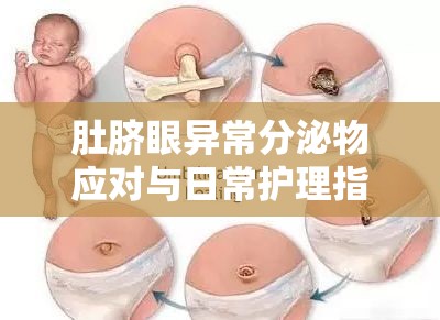 肚臍眼異常分泌物應(yīng)對(duì)與日常護(hù)理指南