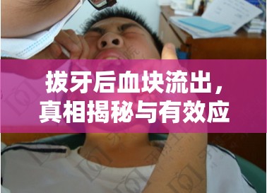 拔牙后血塊流出，真相揭秘與有效應(yīng)對策略