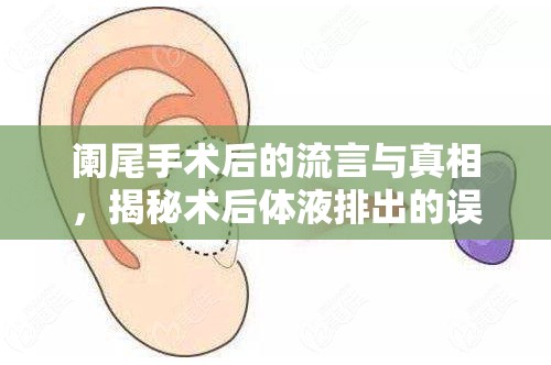 闌尾手術(shù)后的流言與真相，揭秘術(shù)后體液排出的誤解
