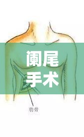 闌尾手術(shù)后的流言與真相，揭秘術(shù)后體液排出的誤解