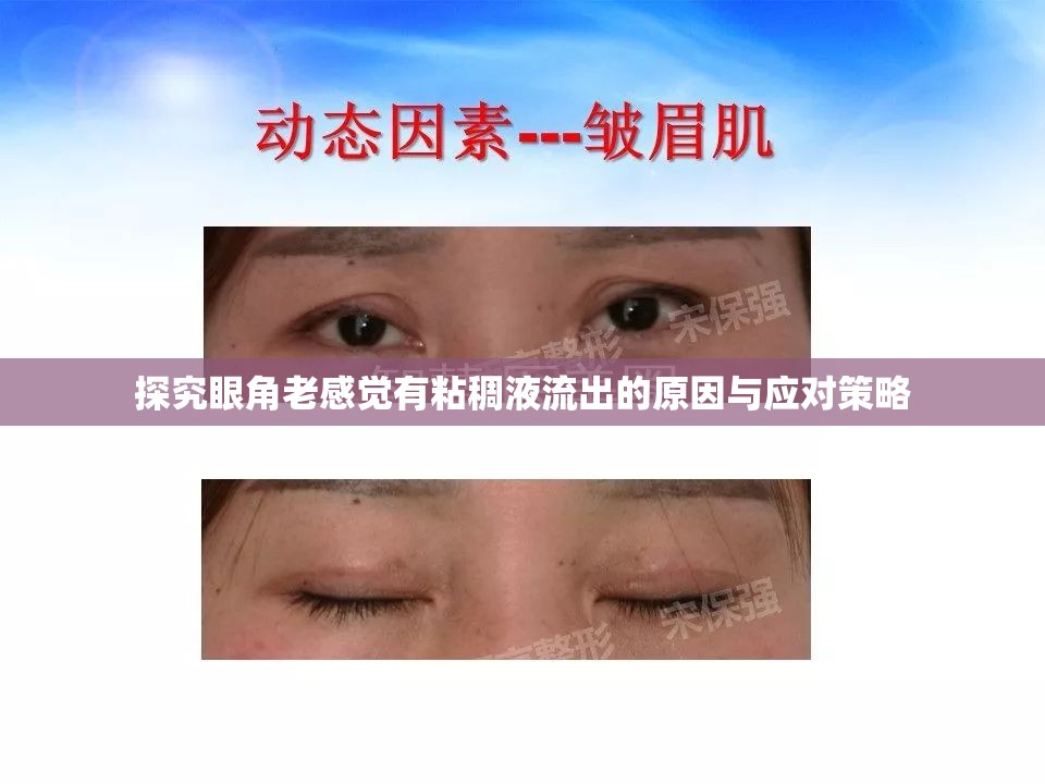 探究眼角老感覺有粘稠液流出的原因與應(yīng)對(duì)策略