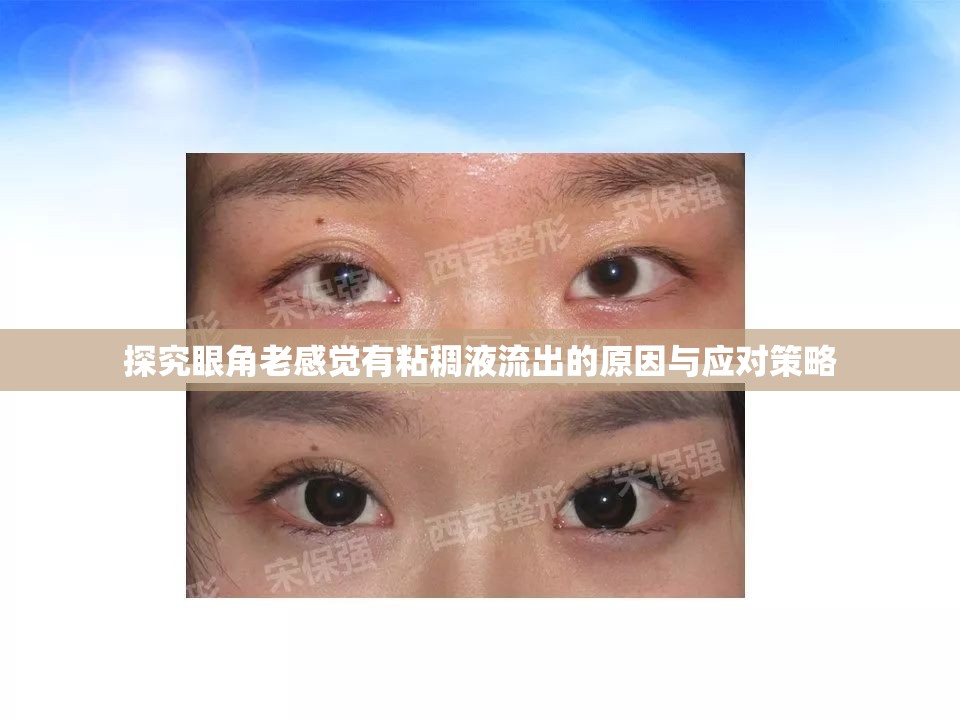探究眼角老感覺有粘稠液流出的原因與應(yīng)對(duì)策略