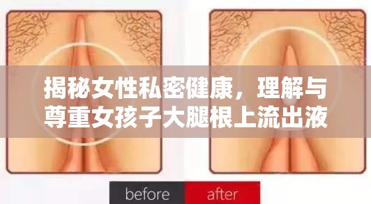 揭秘女性私密健康，理解與尊重女孩子大腿根上流出液體的奧秘