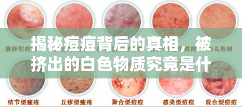 揭秘痘痘背后的真相，被擠出的白色物質(zhì)究竟是什么？