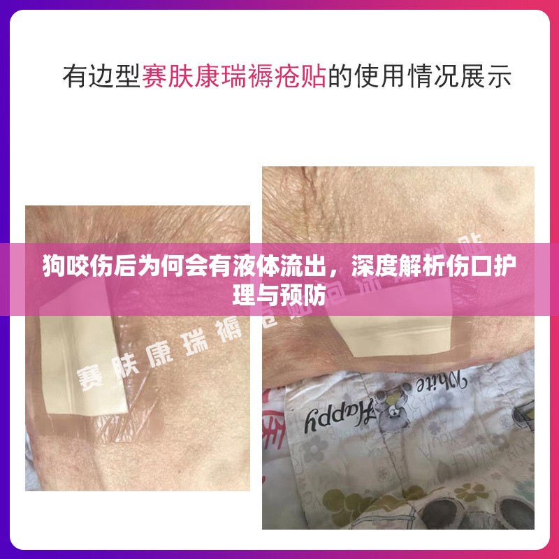 狗咬傷后為何會(huì)有液體流出，深度解析傷口護(hù)理與預(yù)防