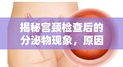 揭秘宮頸檢查后的分泌物現(xiàn)象，原因與解讀