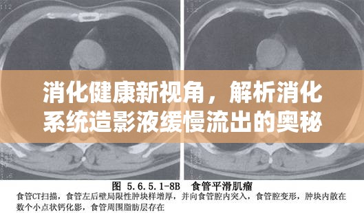 消化健康新視角，解析消化系統(tǒng)造影液緩慢流出的奧秘