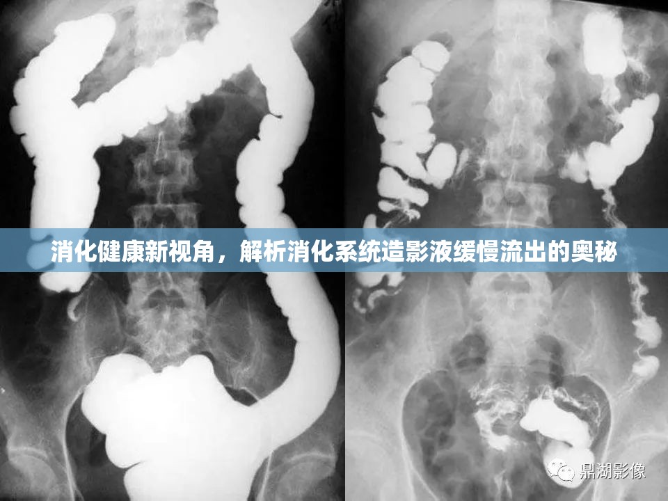 消化健康新視角，解析消化系統(tǒng)造影液緩慢流出的奧秘
