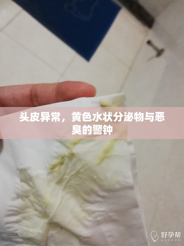 頭皮異常，黃色水狀分泌物與惡臭的警鐘