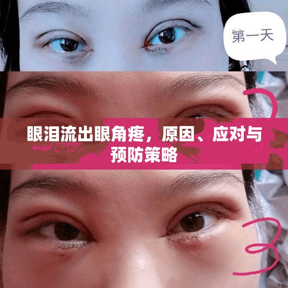 眼淚流出眼角疼，原因、應(yīng)對與預(yù)防策略