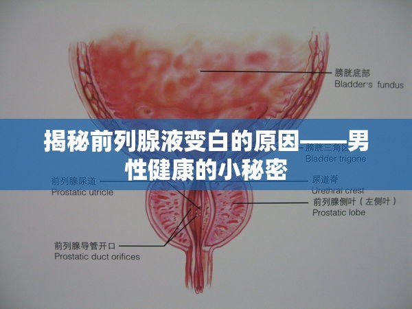 揭秘前列腺液變白的原因——男性健康的小秘密