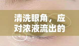 清洗眼角，應(yīng)對(duì)濃液流出的有效措施與注意事項(xiàng)