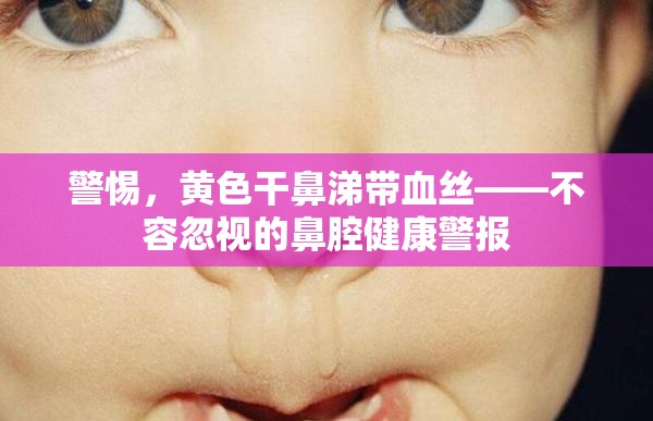 警惕，黃色干鼻涕帶血絲——不容忽視的鼻腔健康警報(bào)