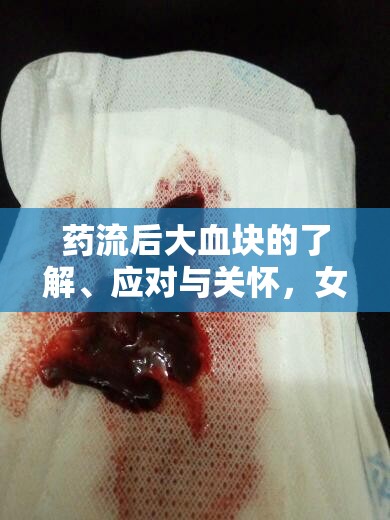 藥流后大血塊的了解、應(yīng)對與關(guān)懷，女性健康的重要一課