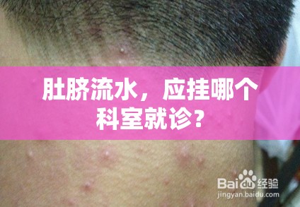 肚臍流水，應掛哪個科室就診？