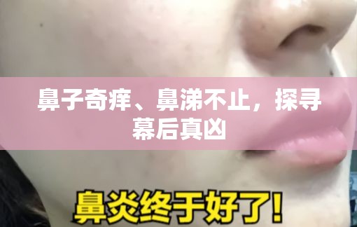 鼻子奇癢、鼻涕不止，探尋幕后真兇