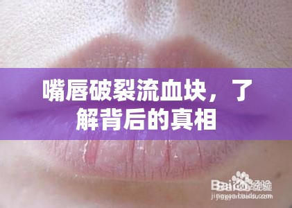 嘴唇破裂流血塊，了解背后的真相