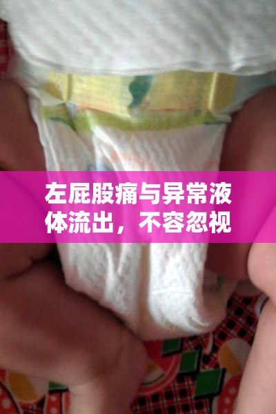 左屁股痛與異常液體流出，不容忽視的身體健康警報