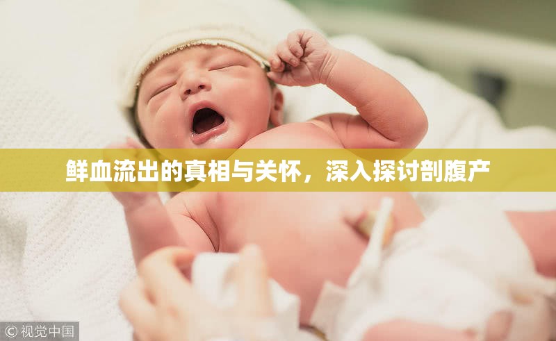 鮮血流出的真相與關(guān)懷，深入探討剖腹產(chǎn)