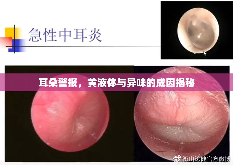 耳朵警報，黃液體與異味的成因揭秘