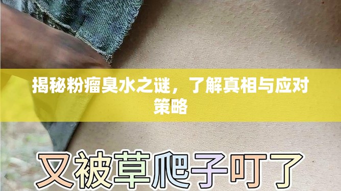 揭秘粉瘤臭水之謎，了解真相與應對策略