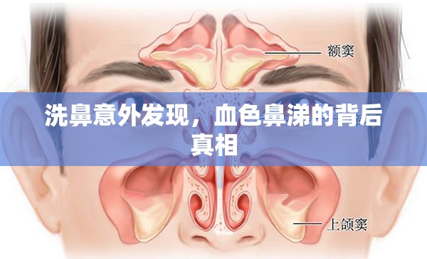 洗鼻意外發(fā)現(xiàn)，血色鼻涕的背后真相