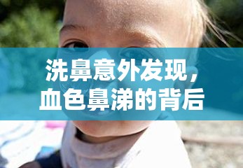 洗鼻意外發(fā)現(xiàn)，血色鼻涕的背后真相