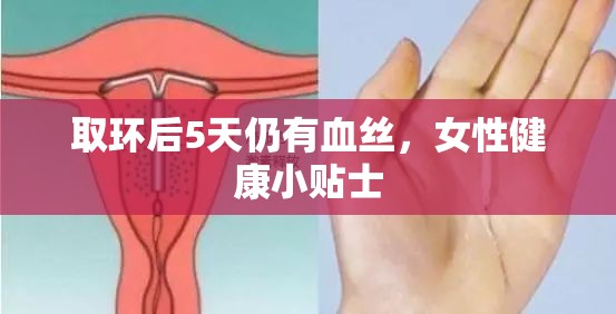 取環(huán)后5天仍有血絲，女性健康小貼士