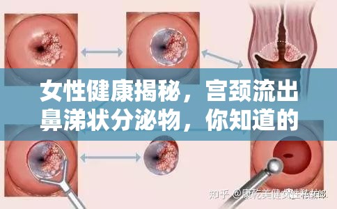 女性健康揭秘，宮頸流出鼻涕狀分泌物，你知道的真相