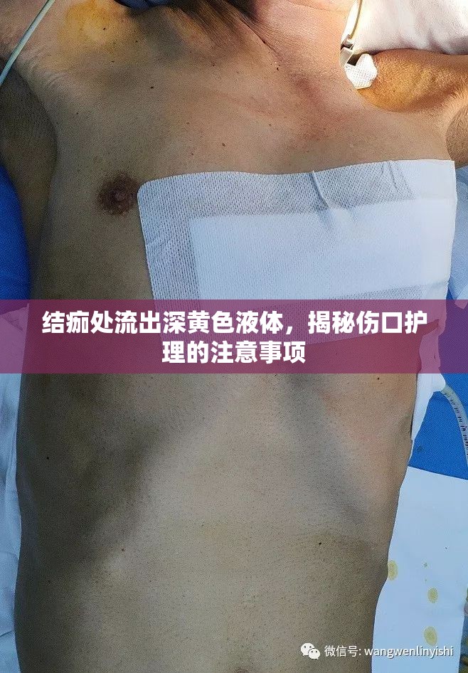 結(jié)痂處流出深黃色液體，揭秘傷口護理的注意事項