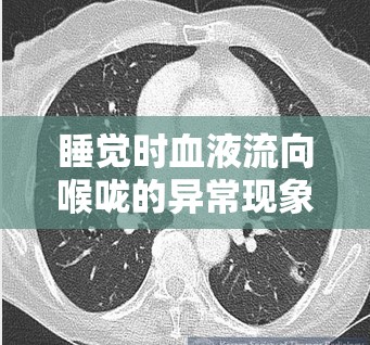 睡覺時血液流向喉嚨的異常現(xiàn)象