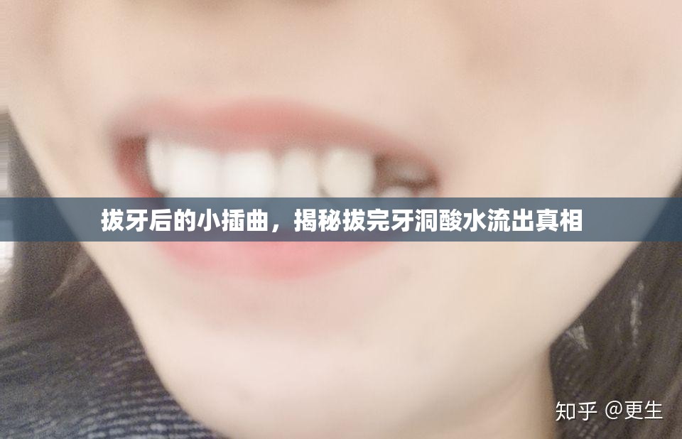 拔牙后的小插曲，揭秘拔完牙洞酸水流出真相