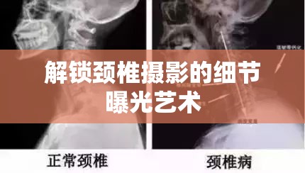 解鎖頸椎攝影的細(xì)節(jié)曝光藝術(shù)