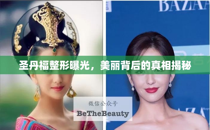 圣丹福整形曝光，美麗背后的真相揭秘