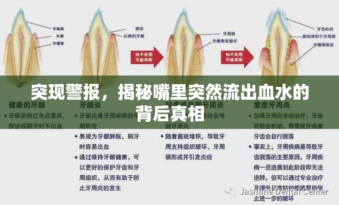 突現(xiàn)警報(bào)，揭秘嘴里突然流出血水的背后真相