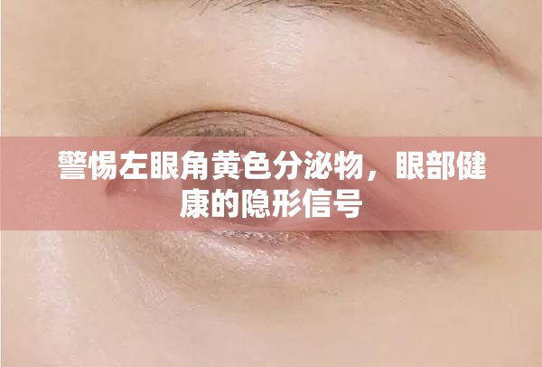 警惕左眼角黃色分泌物，眼部健康的隱形信號