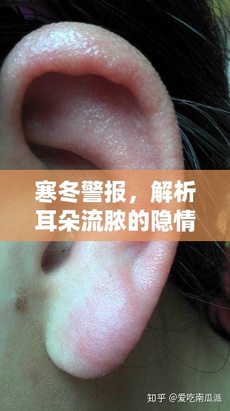 寒冬警報，解析耳朵流膿的隱情與冬季應對策略