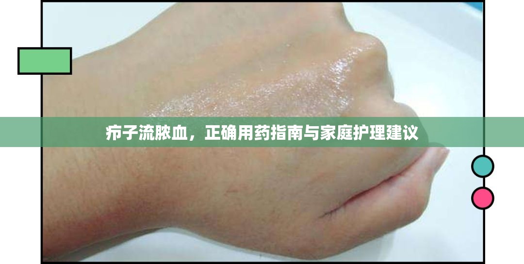 癤子流膿血，正確用藥指南與家庭護理建議