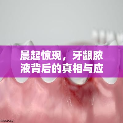 晨起驚現(xiàn)，牙齦膿液背后的真相與應(yīng)對(duì)策略