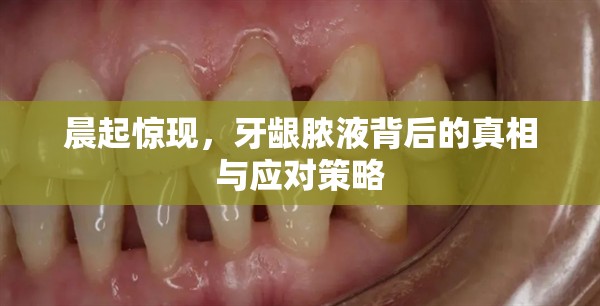 晨起驚現(xiàn)，牙齦膿液背后的真相與應(yīng)對(duì)策略