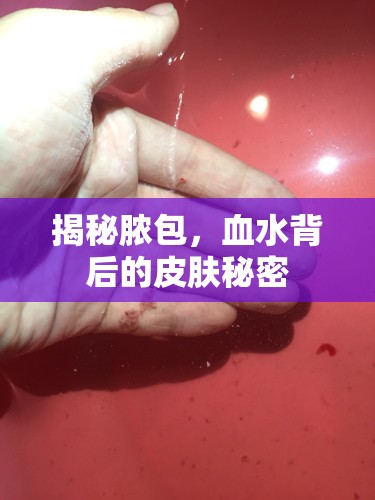 揭秘膿包，血水背后的皮膚秘密