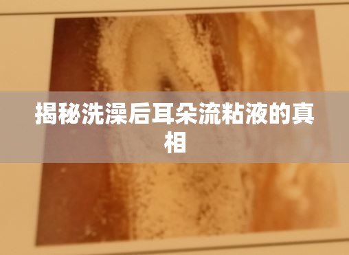 揭秘洗澡后耳朵流粘液的真相