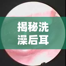 揭秘洗澡后耳朵流粘液的真相