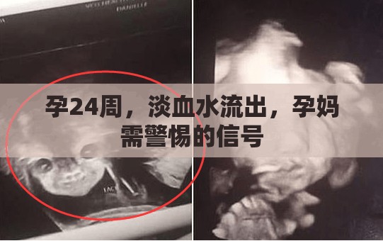孕24周，淡血水流出，孕媽需警惕的信號