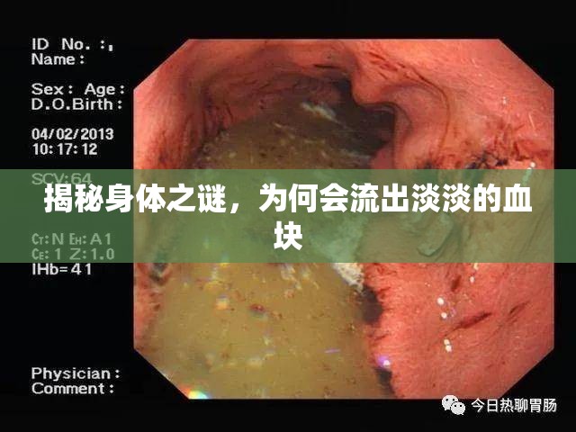 揭秘身體之謎，為何會(huì)流出淡淡的血塊