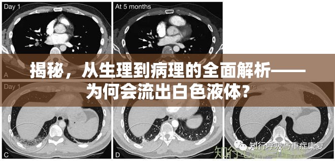 揭秘，從生理到病理的全面解析——為何會流出白色液體？