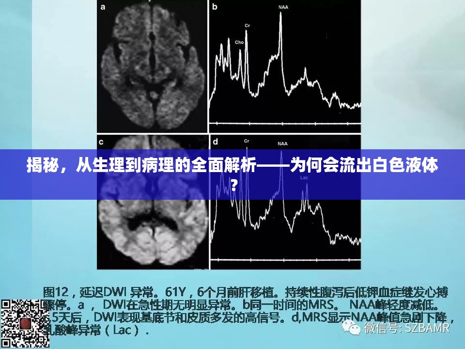 揭秘，從生理到病理的全面解析——為何會流出白色液體？